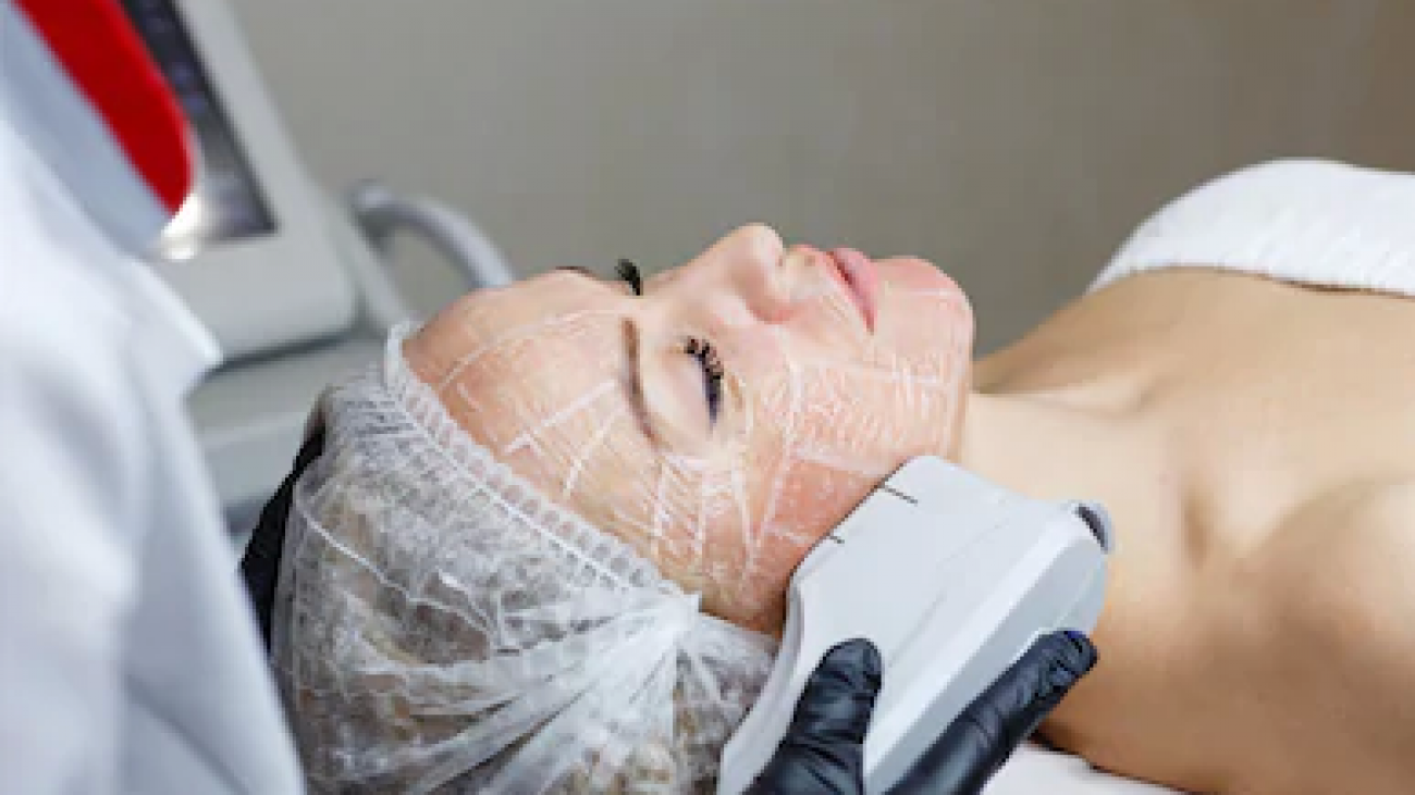 Vampire facelift